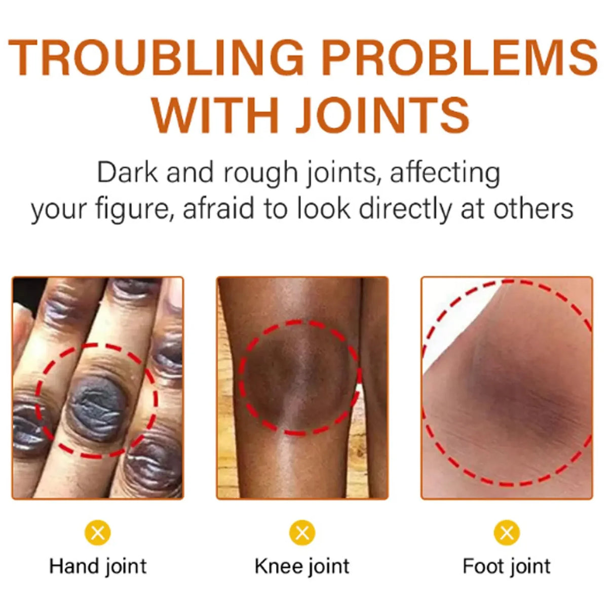 Body Whitening Bleach Cream Brighten Underarm Elbow Knees Joint Removal Intimate Parts Dark Spots Melanin Snow Bleach Cream