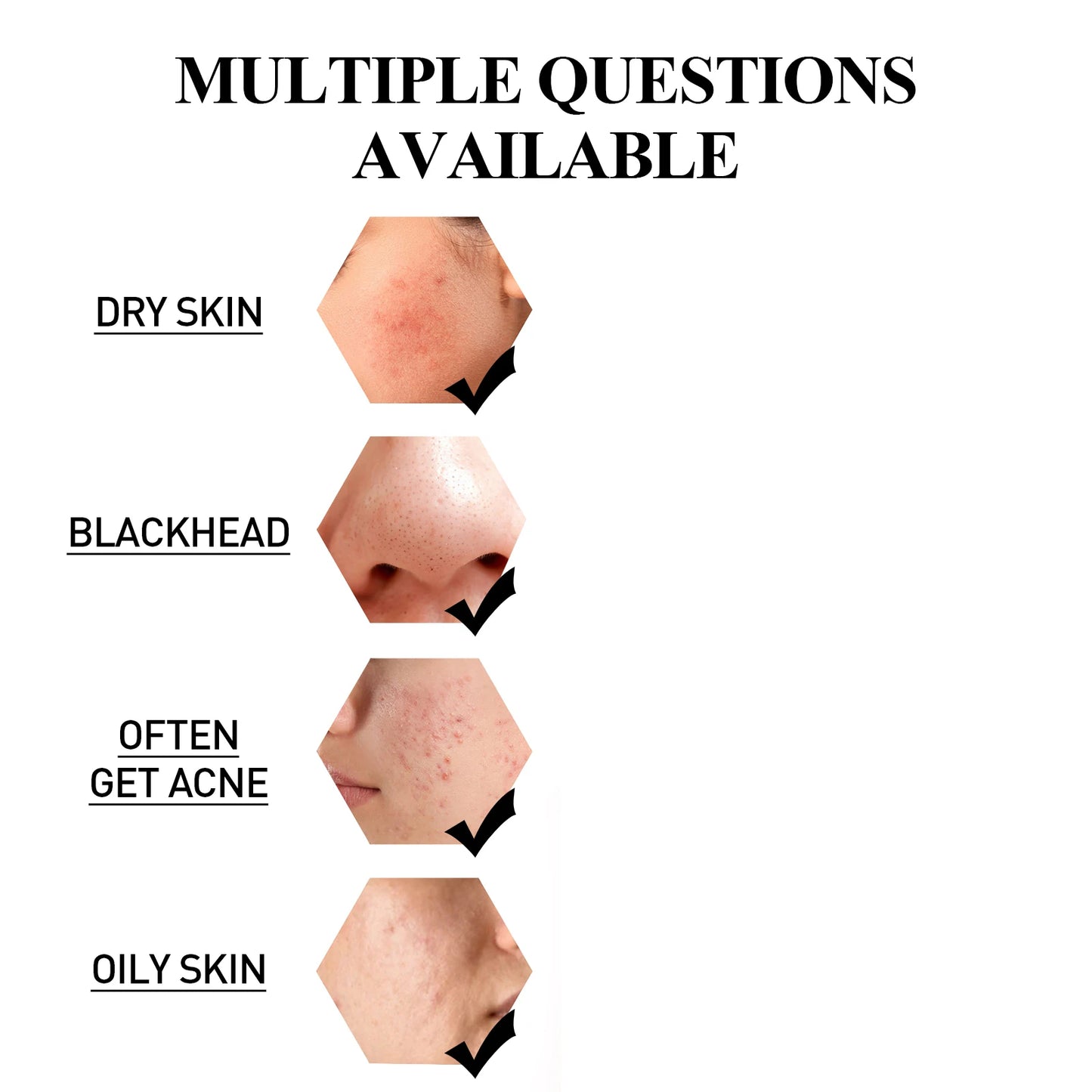 Blackhead Remover Mask Charcoal Peel Cleaner Oil Control Anti Ac-ne Pores Shrink Purifying Clay Deep Cleaning Solid Mask Stick