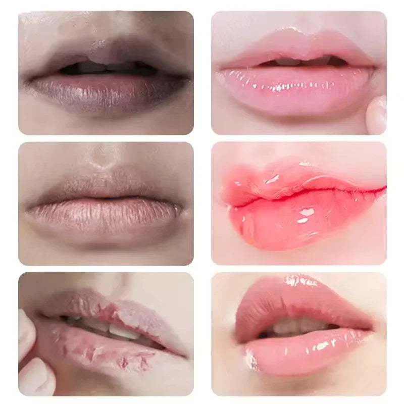 Remove Dark Lip Balm Fast Lightening Pink Lip Exfoliating Fade Lip Line Dead Skin Moisturizer Korean Care Products Beauty Health
