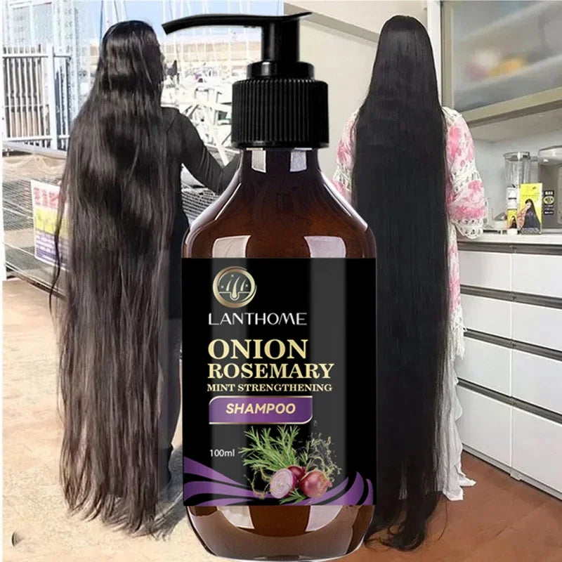 Hair Shampoo For Fast Hair Growth Rosemary Onion Hair Regrowth Shampoo Anti Hair Loss Effective Within 7 Day Hair Care Spray